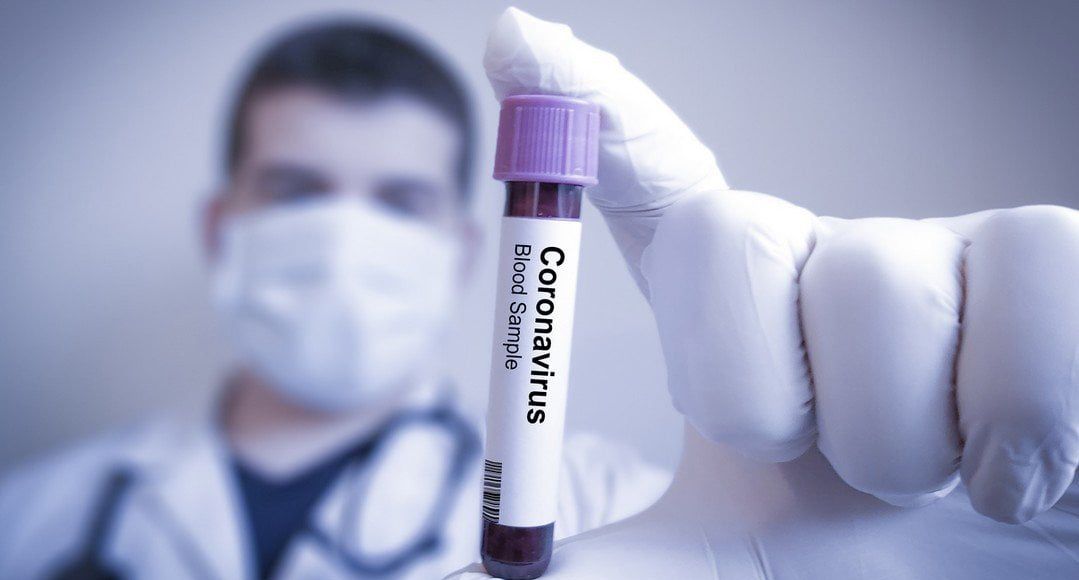Coronavirus.jpg